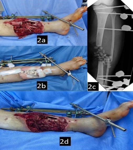 Зображення, що містить медичний, Медичне обладнання, охорона здоров’я, кімната

Автоматично згенерований опис