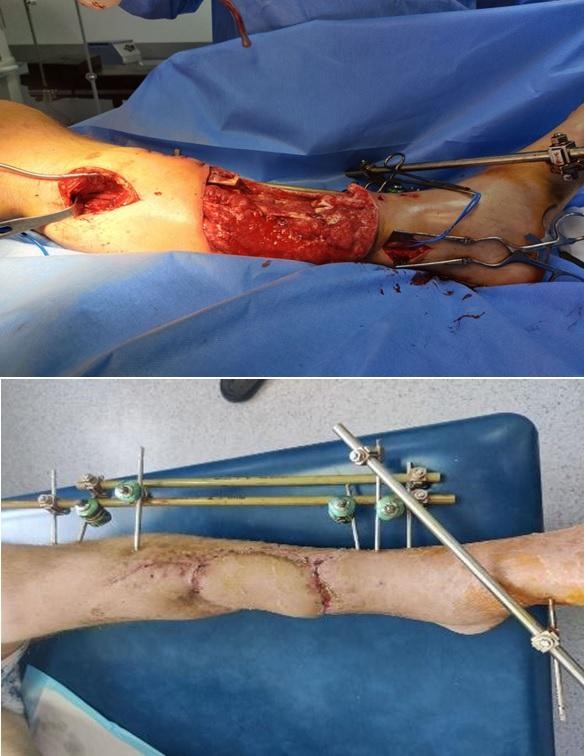 Зображення, що містить кімната, сцена, Медичне обладнання, медичний

Автоматично згенерований опис